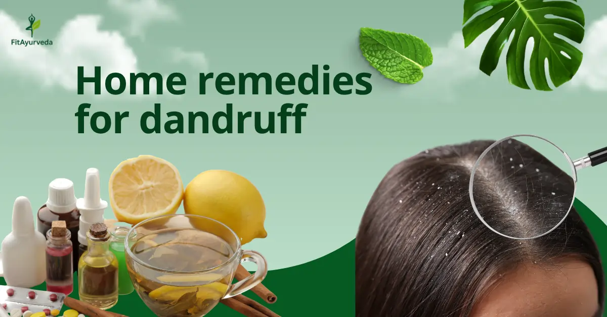 Home Remedies for Dandruff: Natural Ways to Get a Healthy Scalp